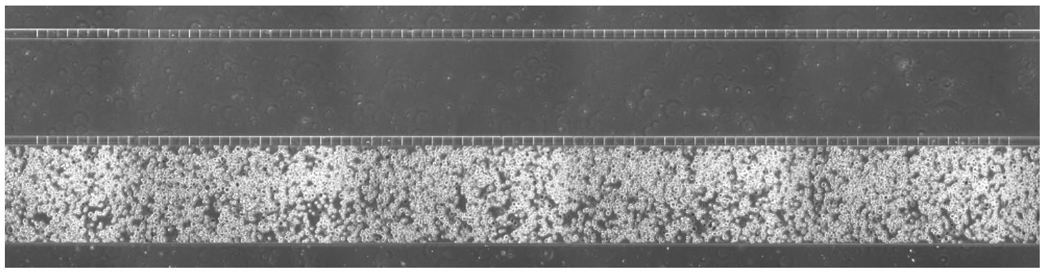 An_example_of_a_confluent_endothelial_cell_seeding_density_in_one_of_the_outer_channels.jpg